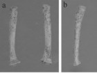 Giuffra, V., Vitiello, A., Caramella, D., Fornaciari, A., Giustini, D. and Fornaciari, G. (2013), Rickets in a High Social Class of Renaissance Italy: The Medici Children. Int. J. Osteoarchaeol.. doi: 10.1002/oa.2324