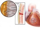 Karp et al., Sci. Transl. Med. DOI: 10.1126/scitranslmed.3006557