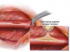 Karp et al., Sci. Transl. Med. DOI: 10.1126/scitranslmed.3006557