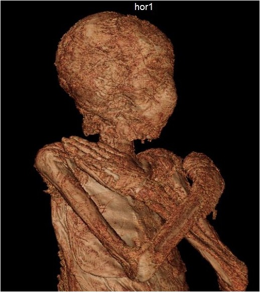 Warsaw Mummy Project