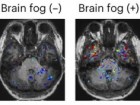 Greene, C., Connolly, R., Brennan, D. et al. Blood–brain barrier disruption..., Nat Neurosci (2024). https://doi.org/10.1038/s41593-024-01576-9, CC BY SA 4.0